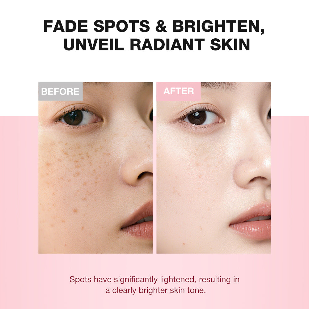 10% Niacinamide Dark Spot Correcting Serum